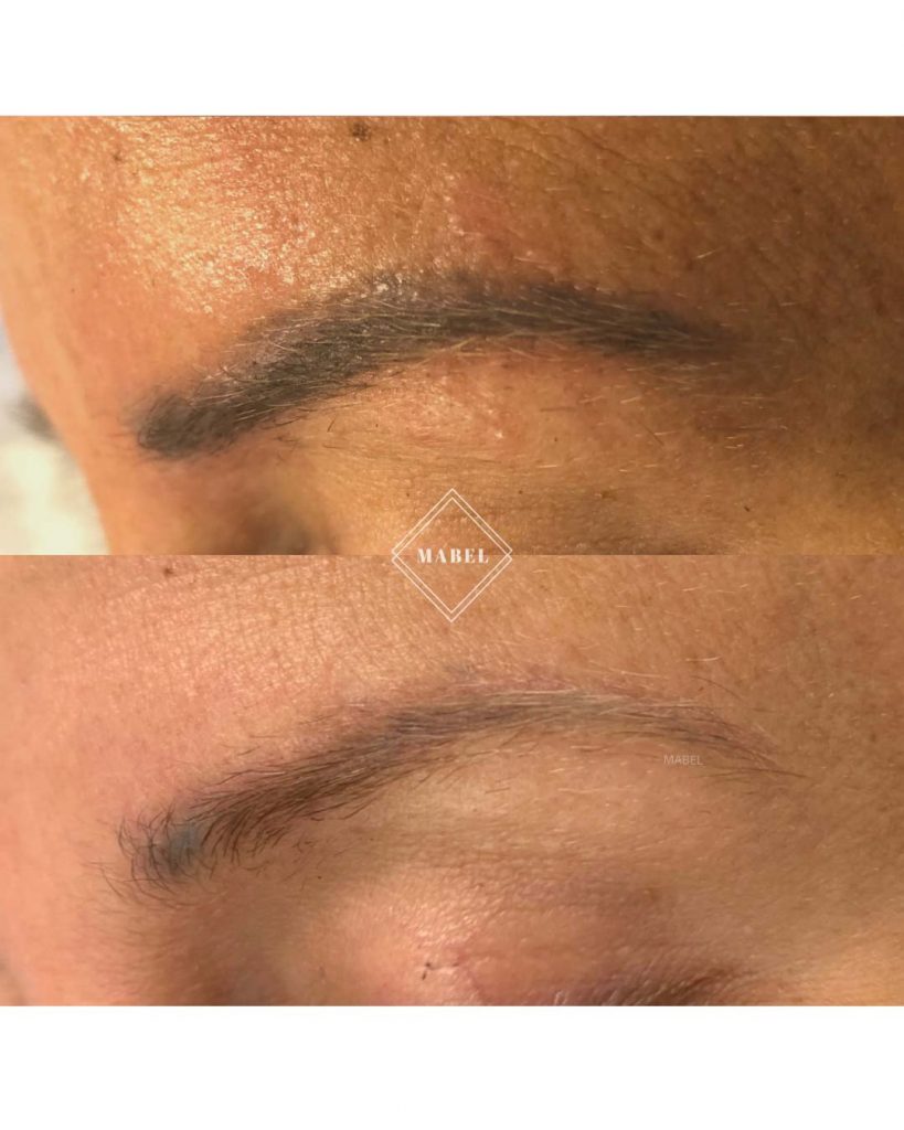 Microblading kulmien poisto ennen jälkeen