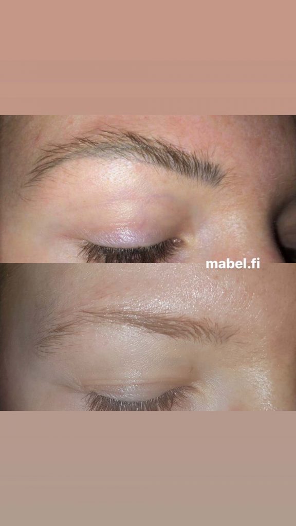 Microblading kulmien poisto ennen jälkeen