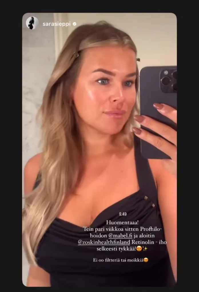 Profhilo hyaluronihappo, ihon kosteutus, esteettisethoidot Helsinki