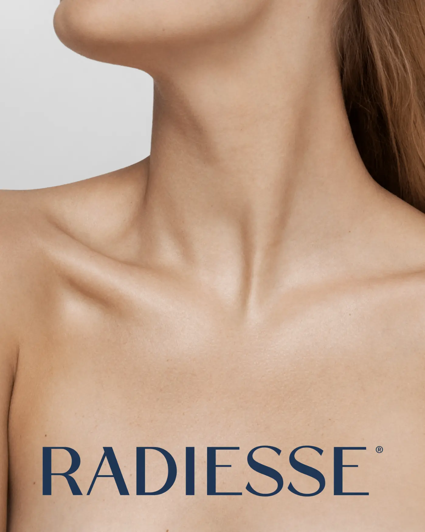 Radiesse Mabel Helsinki